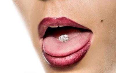 Tongue Rings Can Be Fatal: Preventing Infections