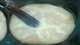 What are Dental Sealants?