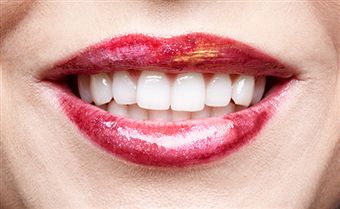 The Common Types of Sedation Dentistry